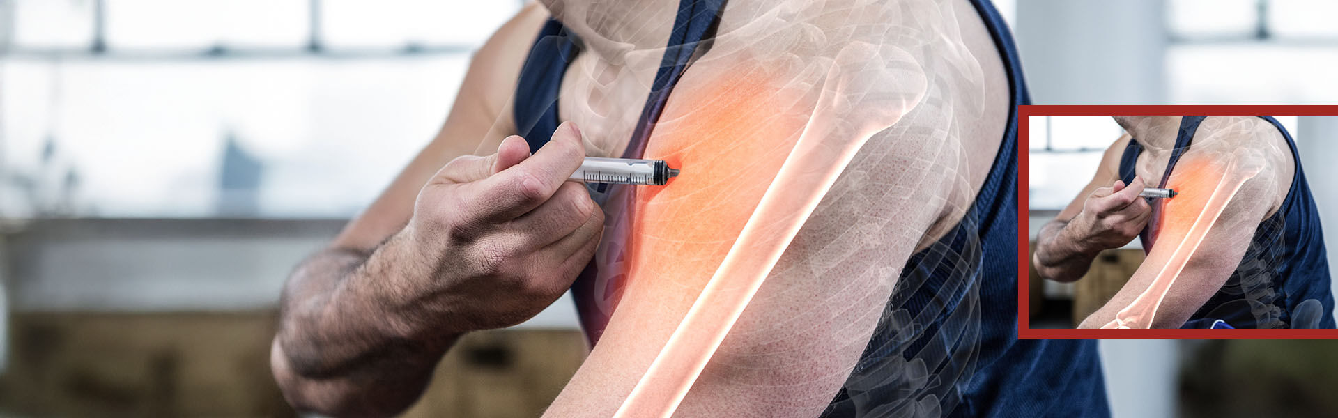 Nahaufnahme eines Mannes, der sich mit einer Spritze in den Oberarm sticht, wobei die Schulterknochen schemenhaft sichtbar sind.